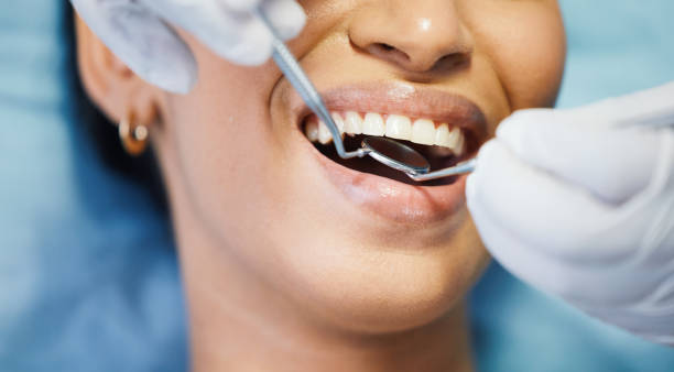 Fast & Reliable Emergency Dental Services in LA